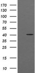 ACAA2 Antibody in Western Blot (WB)