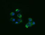 ACAA2 Antibody in Immunocytochemistry (ICC/IF)