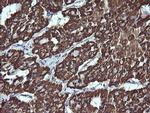 ACAA2 Antibody in Immunohistochemistry (Paraffin) (IHC (P))