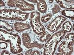 ACAA2 Antibody in Immunohistochemistry (Paraffin) (IHC (P))