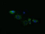 ACAA2 Antibody in Immunocytochemistry (ICC/IF)