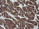 ACAA2 Antibody in Immunohistochemistry (Paraffin) (IHC (P))