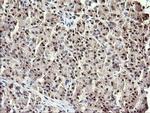 RFC4 Antibody in Immunohistochemistry (Paraffin) (IHC (P))