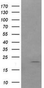 APC11 Antibody in Western Blot (WB)