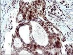 PMS2 Antibody in Immunohistochemistry (Paraffin) (IHC (P))