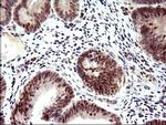 PMS2 Antibody in Immunohistochemistry (Paraffin) (IHC (P))