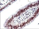 PMS2 Antibody in Immunohistochemistry (Paraffin) (IHC (P))