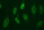 PMS2 Antibody in Immunocytochemistry (ICC/IF)