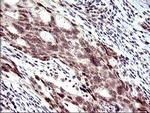 PMS2 Antibody in Immunohistochemistry (Paraffin) (IHC (P))