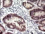 PMS2 Antibody in Immunohistochemistry (Paraffin) (IHC (P))