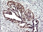 PMS2 Antibody in Immunohistochemistry (Paraffin) (IHC (P))