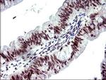 PMS2 Antibody in Immunohistochemistry (Paraffin) (IHC (P))