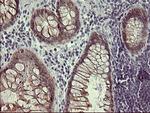 IFNGR2 Antibody in Immunohistochemistry (Paraffin) (IHC (P))