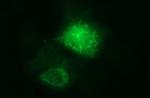 Arginase 2 Antibody in Immunocytochemistry (ICC/IF)