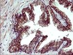 Arginase 2 Antibody in Immunohistochemistry (Paraffin) (IHC (P))