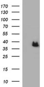 Arginase 2 Antibody in Western Blot (WB)