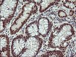 RAPGEF1 Antibody in Immunohistochemistry (Paraffin) (IHC (P))