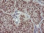 RAPGEF1 Antibody in Immunohistochemistry (Paraffin) (IHC (P))