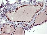 RAPGEF1 Antibody in Immunohistochemistry (Paraffin) (IHC (P))