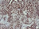 RAPGEF1 Antibody in Immunohistochemistry (Paraffin) (IHC (P))