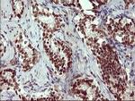 RAPGEF1 Antibody in Immunohistochemistry (Paraffin) (IHC (P))