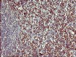 PPAP2A Antibody in Immunohistochemistry (Paraffin) (IHC (P))