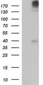 PLB1 Antibody in Western Blot (WB)