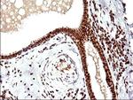 POLR3GL Antibody in Immunohistochemistry (Paraffin) (IHC (P))