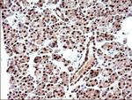 POLR3GL Antibody in Immunohistochemistry (Paraffin) (IHC (P))