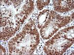 POLR3GL Antibody in Immunohistochemistry (Paraffin) (IHC (P))