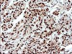 POLR3GL Antibody in Immunohistochemistry (Paraffin) (IHC (P))