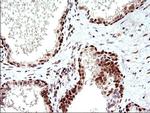 POLR3GL Antibody in Immunohistochemistry (Paraffin) (IHC (P))