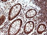 POLR3GL Antibody in Immunohistochemistry (Paraffin) (IHC (P))