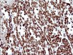 POLR3GL Antibody in Immunohistochemistry (Paraffin) (IHC (P))