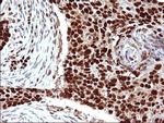 POLR3GL Antibody in Immunohistochemistry (Paraffin) (IHC (P))