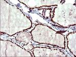 UPRT Antibody in Immunohistochemistry (Paraffin) (IHC (P))