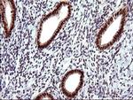 UPRT Antibody in Immunohistochemistry (Paraffin) (IHC (P))