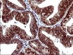 UPRT Antibody in Immunohistochemistry (Paraffin) (IHC (P))