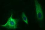 MUT Antibody in Immunocytochemistry (ICC/IF)