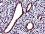 SERPINB3 Antibody in Immunohistochemistry (Paraffin) (IHC (P))