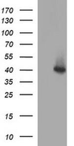 SERPINB3 Antibody in Western Blot (WB)