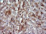 HRASLS3 Antibody in Immunohistochemistry (Paraffin) (IHC (P))