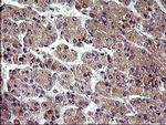 HRASLS3 Antibody in Immunohistochemistry (Paraffin) (IHC (P))