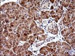 HRASLS3 Antibody in Immunohistochemistry (Paraffin) (IHC (P))