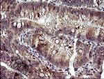 HRASLS3 Antibody in Immunohistochemistry (Paraffin) (IHC (P))