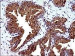 HRASLS3 Antibody in Immunohistochemistry (Paraffin) (IHC (P))