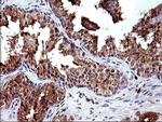 HRASLS3 Antibody in Immunohistochemistry (Paraffin) (IHC (P))