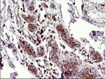 SCAMP2 Antibody in Immunohistochemistry (Paraffin) (IHC (P))