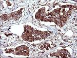 SCAMP2 Antibody in Immunohistochemistry (Paraffin) (IHC (P))