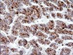 HSD17B4 Antibody in Immunohistochemistry (Paraffin) (IHC (P))